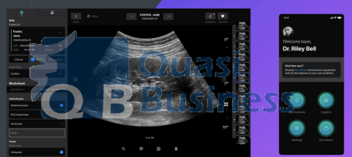 Ultrasound Disruptor Exo Gets $220M in Series C Financing Round | majority us series ventures 16mramaswamytechcrunch